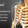 bodystance backpod costochondritis
